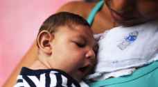 كوستاريكا تسجل أول حالة مولود بصغر حجم الرأس