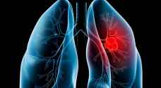 دواء جديد لعلاج سرطان الرئة