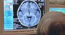 على غرار أطفال الأنابيب.. 'مخ الأنابيب' لوقف الزهايمر!