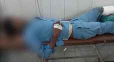 في الهند .. مريض يستعمل ساقه المبتورة كوسادة