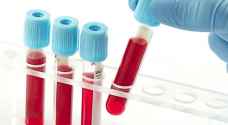 ‎فحص دم يرصد سرطان الرئة في مرحلة مبكرة