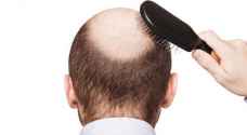 تطوير عقار جديد يعالج تساقط وشيب الشعر