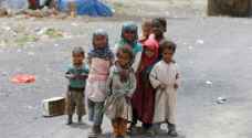 وفاة طفل في اليمن كل 10 دقائق بسبب الجوع والمرض