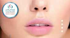 توريد الشفاه!!! - فيديو