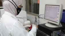 لجنة الأوبئة: فحص الــ PCR هو  الوحيد المعتمد لكوفيد 19 في الأردن