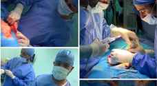 نجاح عملية جراحية نادرة لفصل توأم متلاصق في مستشفى البشير - صور