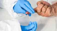 الصحة تجيز اجراء فحوصات الأجسام المضادة لمن أصيبوا بكورونا