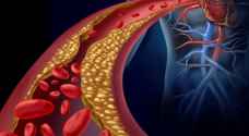 كيف تعرف أنك تعاني من ارتفاع الكوليسترول؟