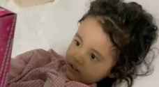 والد الطفلة ضحية الأسيد: طفلتي تعيش ظروفا صعبة