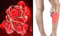 علامات وأعراض الشعور بجلطة الدم