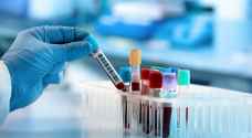 اختبار دم يكتشف ٥٠ نوعا من السرطان