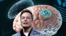 شركة ماسك: الموافقة على زرع شرائح إلكترونية في أدمغة البشر